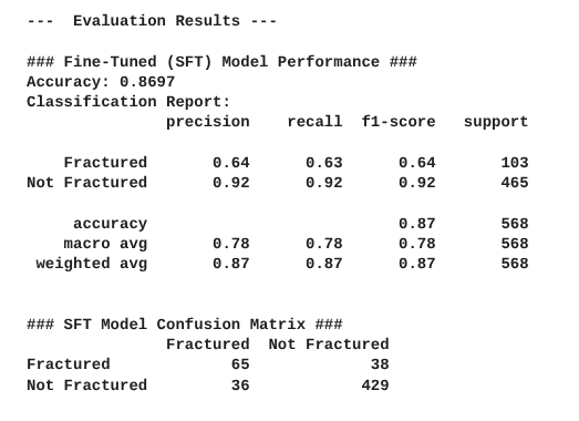 My Tuned Model Results